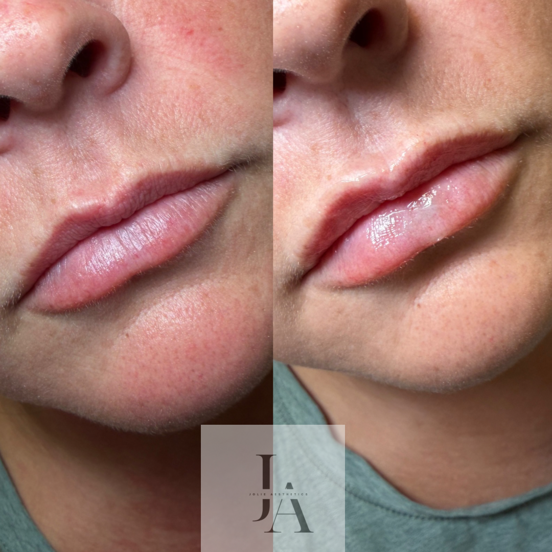 Untitled design - 3.png