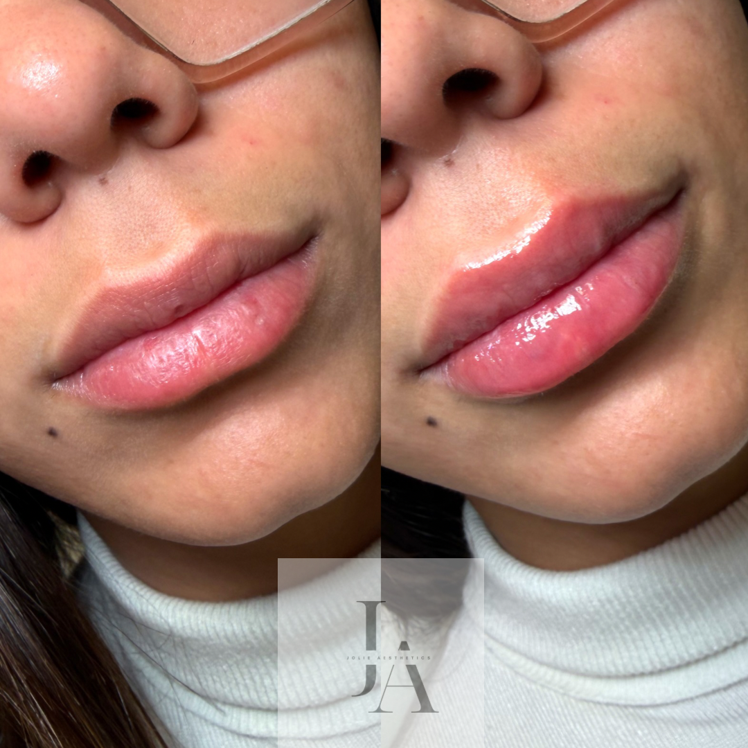 Untitled design 2.png