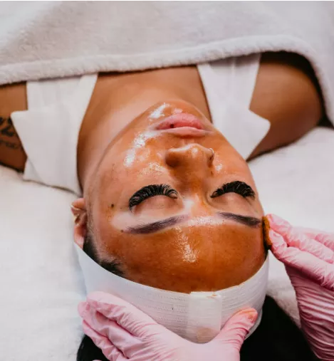 Medspa in Midlothian, VA, 23112 | Chemical Peels Near Me