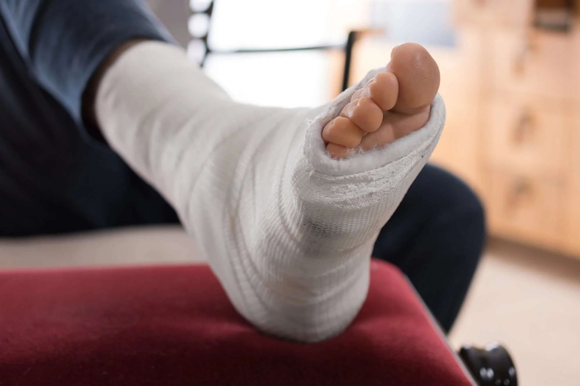Close-up of a person's hand in a cast with fingers exposed, resting on a red surface.