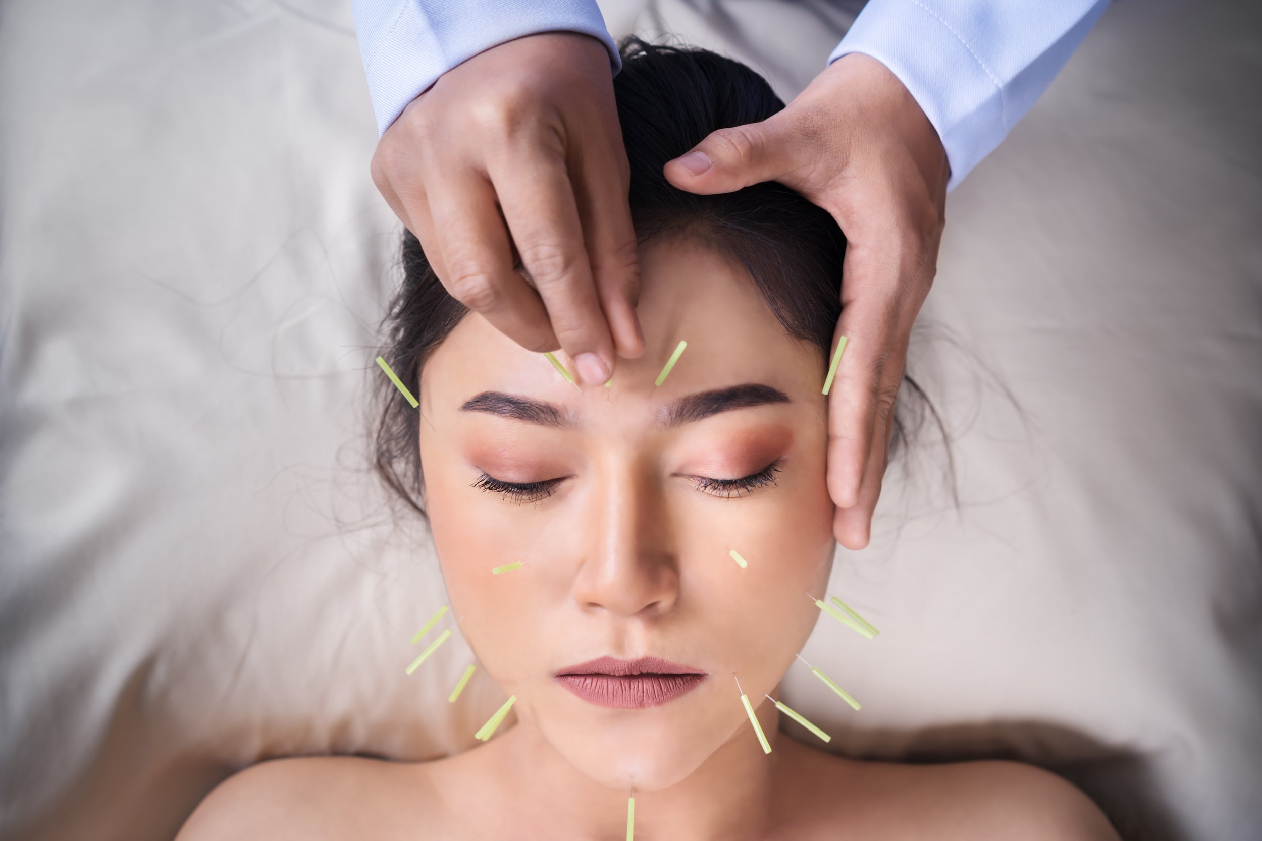 Cosmetic acupuncture is a natural, regenerative treatment designed to support healthy skin by improving circulation, stimulating collagen production, and enhancing the body’s natural repair processes at Core Meridian Acupuncture in Newport Beach, CA.