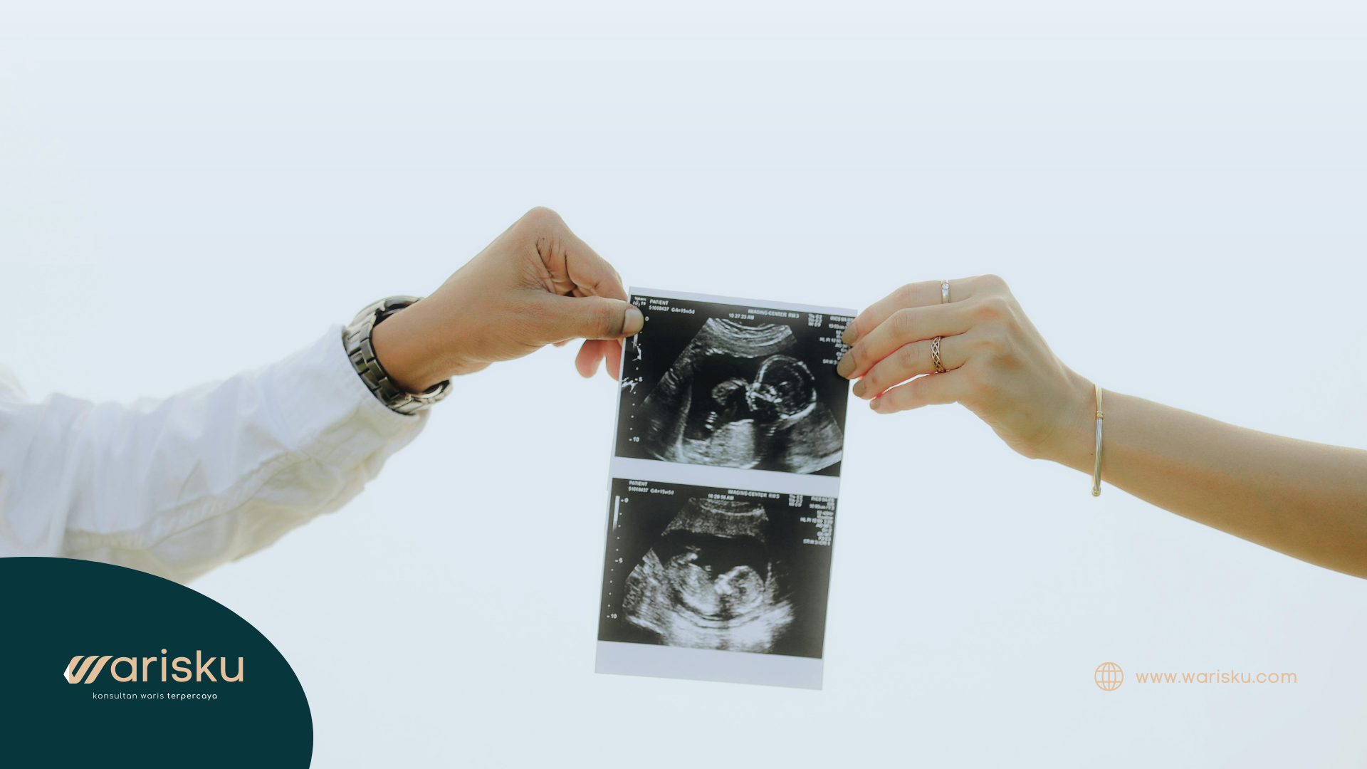 Warisan bagi Anak dalam Kandungan: Bagaimana Status Hukum dan Perlindungan Haknya?