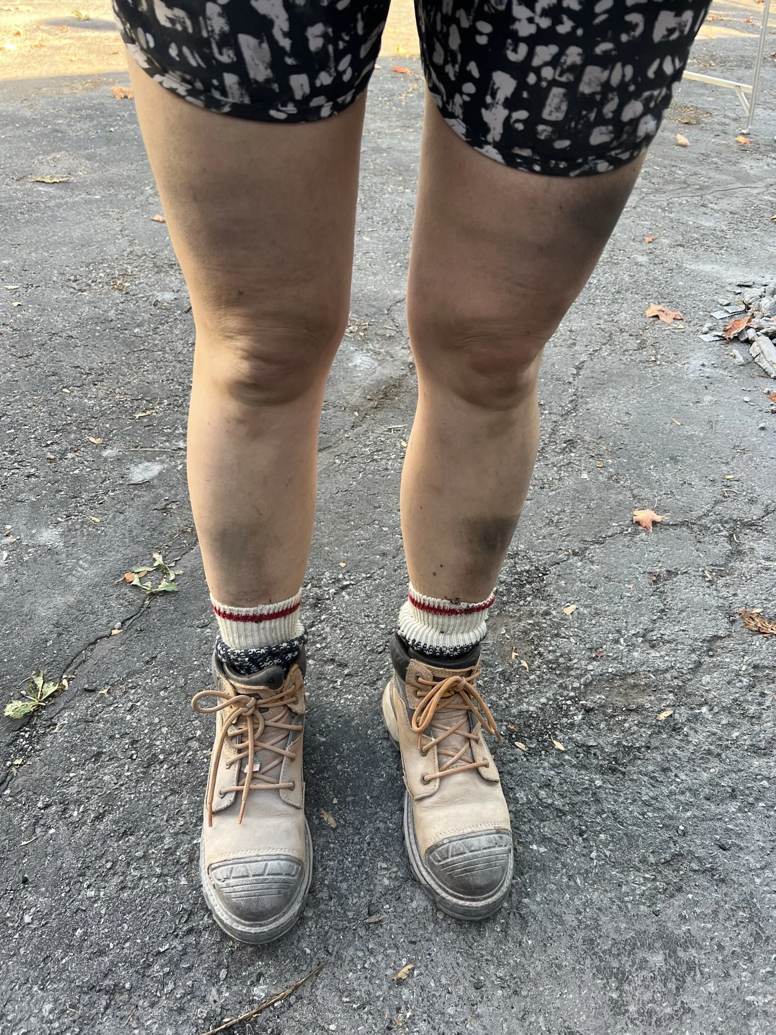 Nest&Notion-interior-design-and-renovation-ottawa-ontario-building-my-nest-clark-kent-main-photo-bruised-legs.JPEG