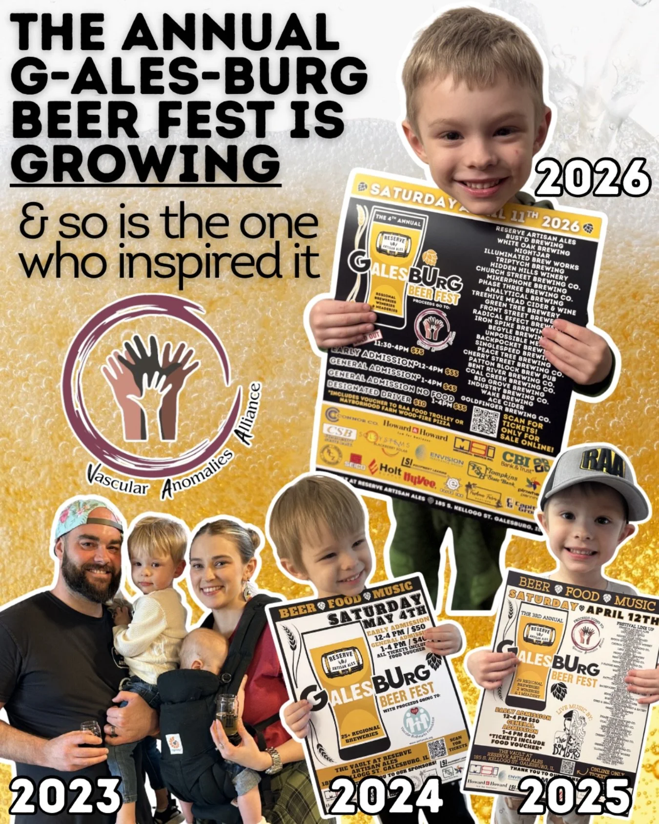 🤔 Do you have your ticket to the 4th Annual G-ALES-Burg Beer Fest yet to support the @vascularally ? Each year, this festival GROWS, just as much as the little guy who inspired it. 

📚1 in 10 babies are born with a vascular birthmark, and 10% of th