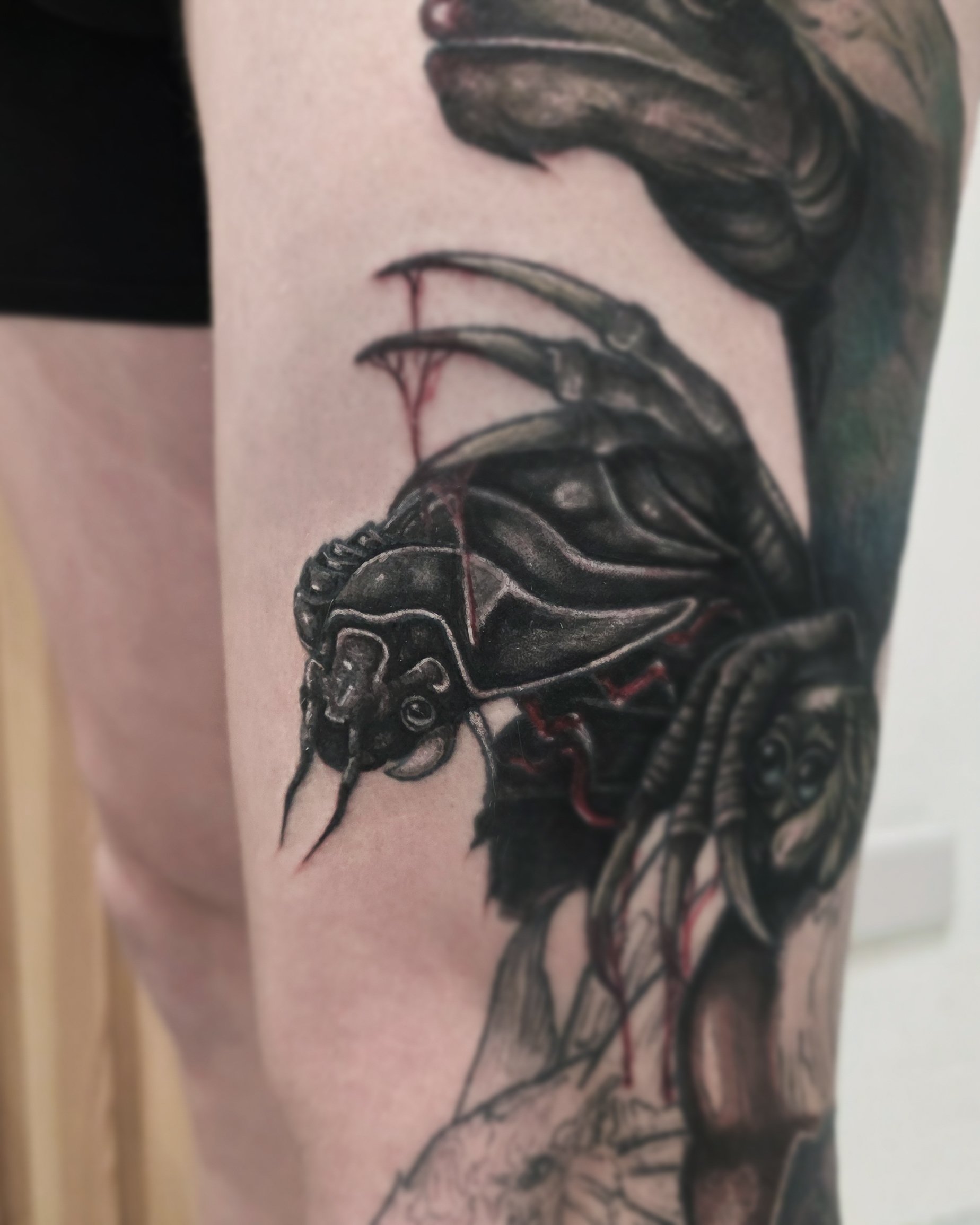 LIAM'S LEG CONT 2-2.jpg