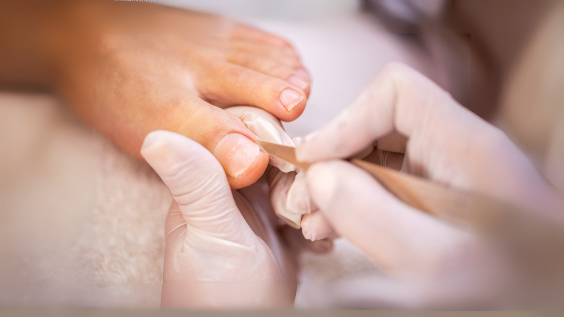 ingrown toenail removal sudbury