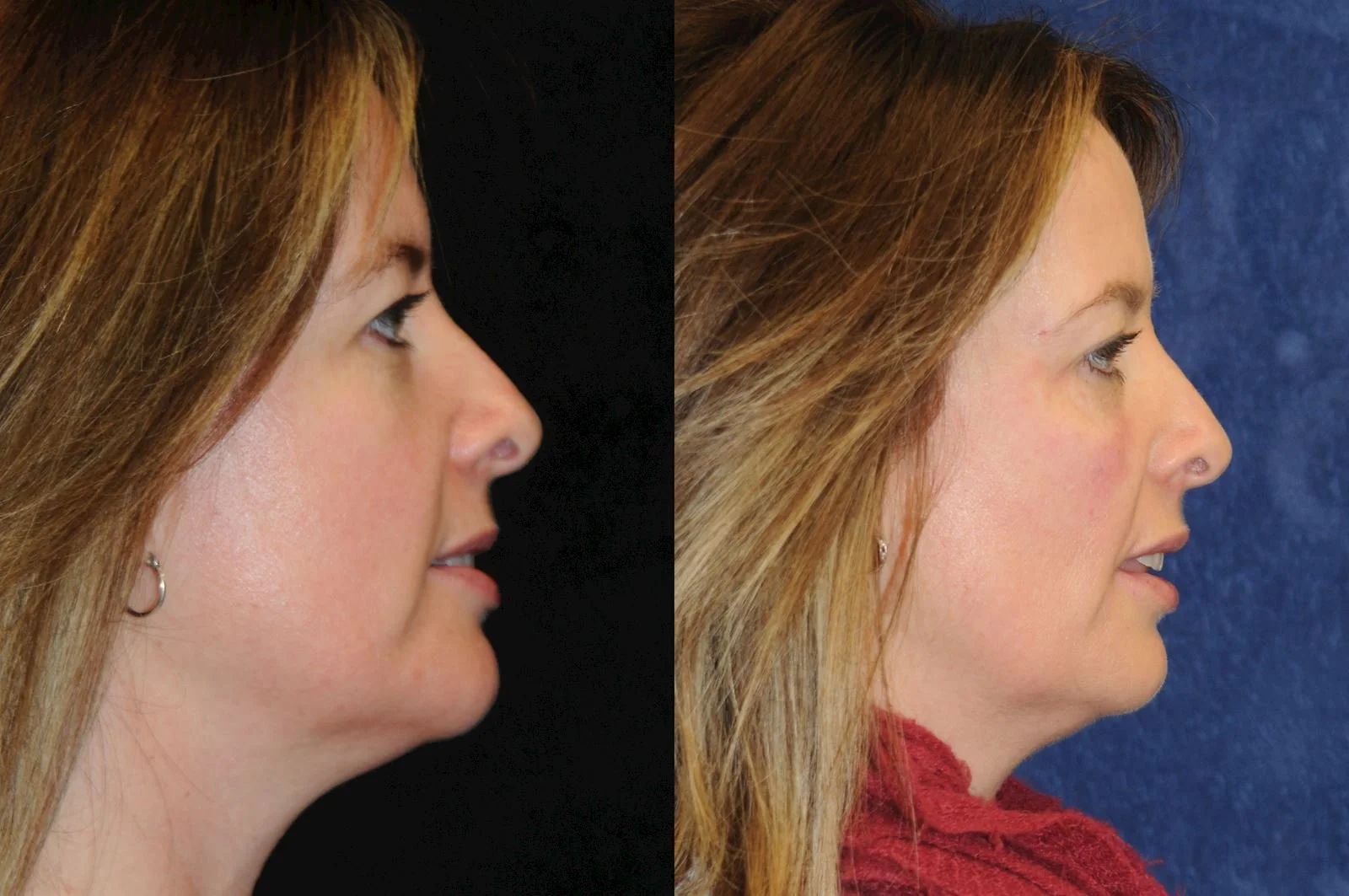 Allen, valena  (20150731140113400) 20160112082358880.jpg