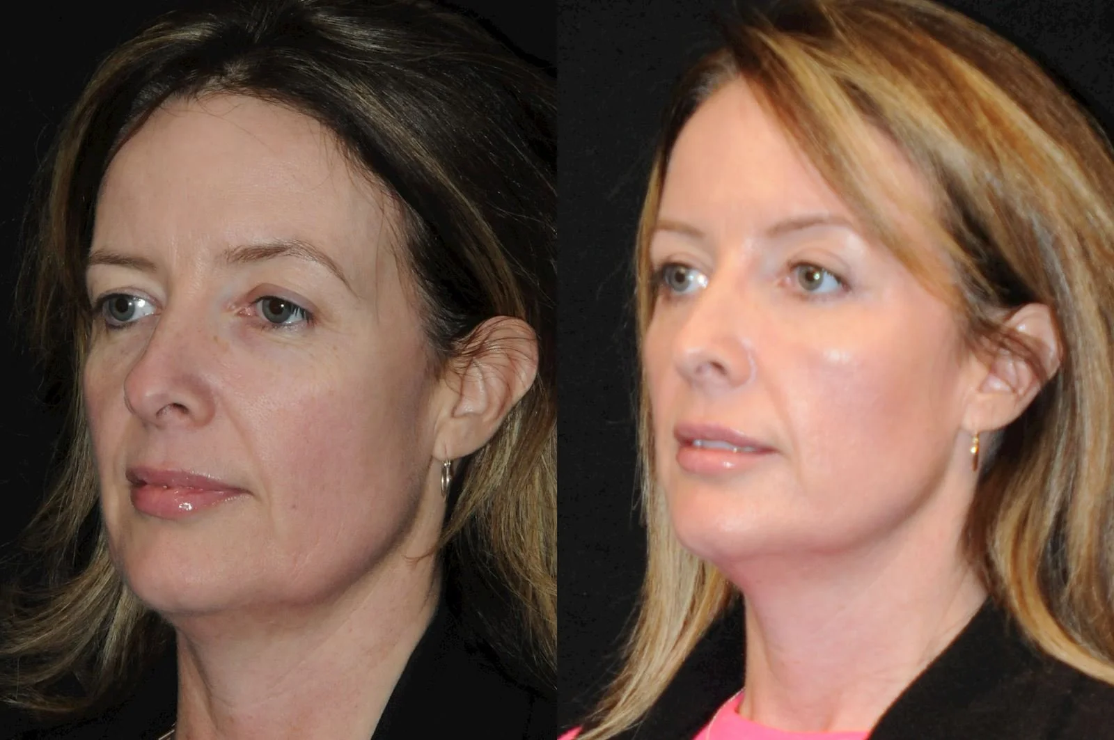 Allen, valena  (20150731140113400) 20170120162427673.jpg