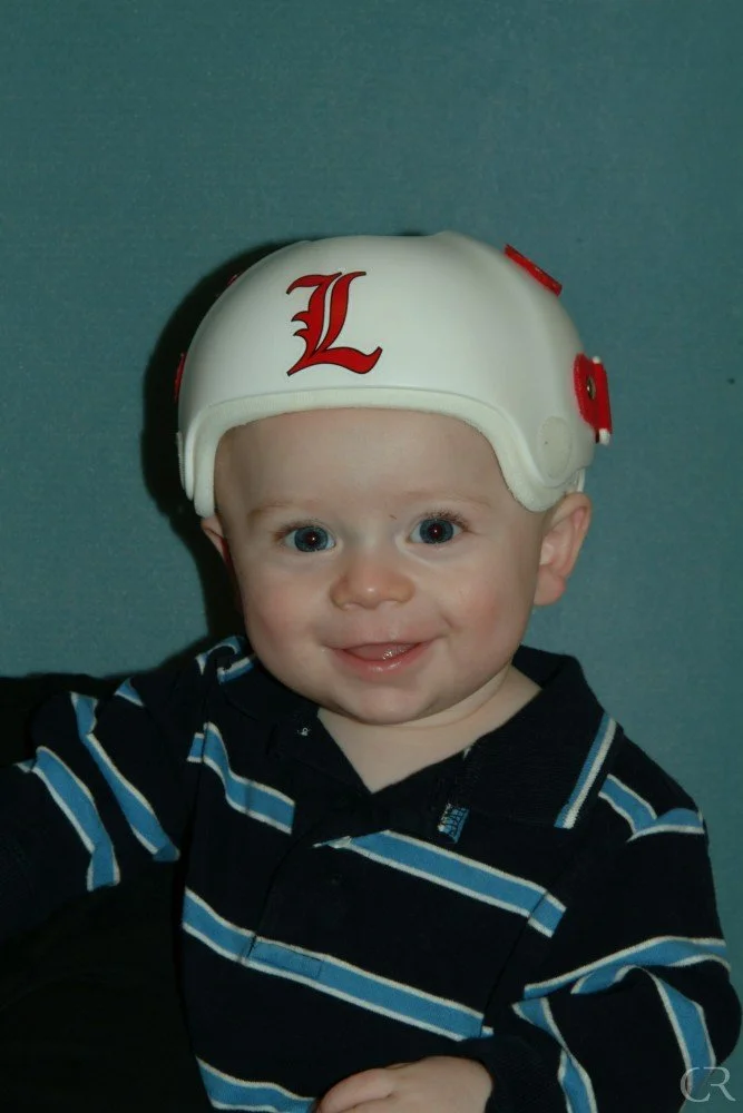plagiocephaly-4.jpg