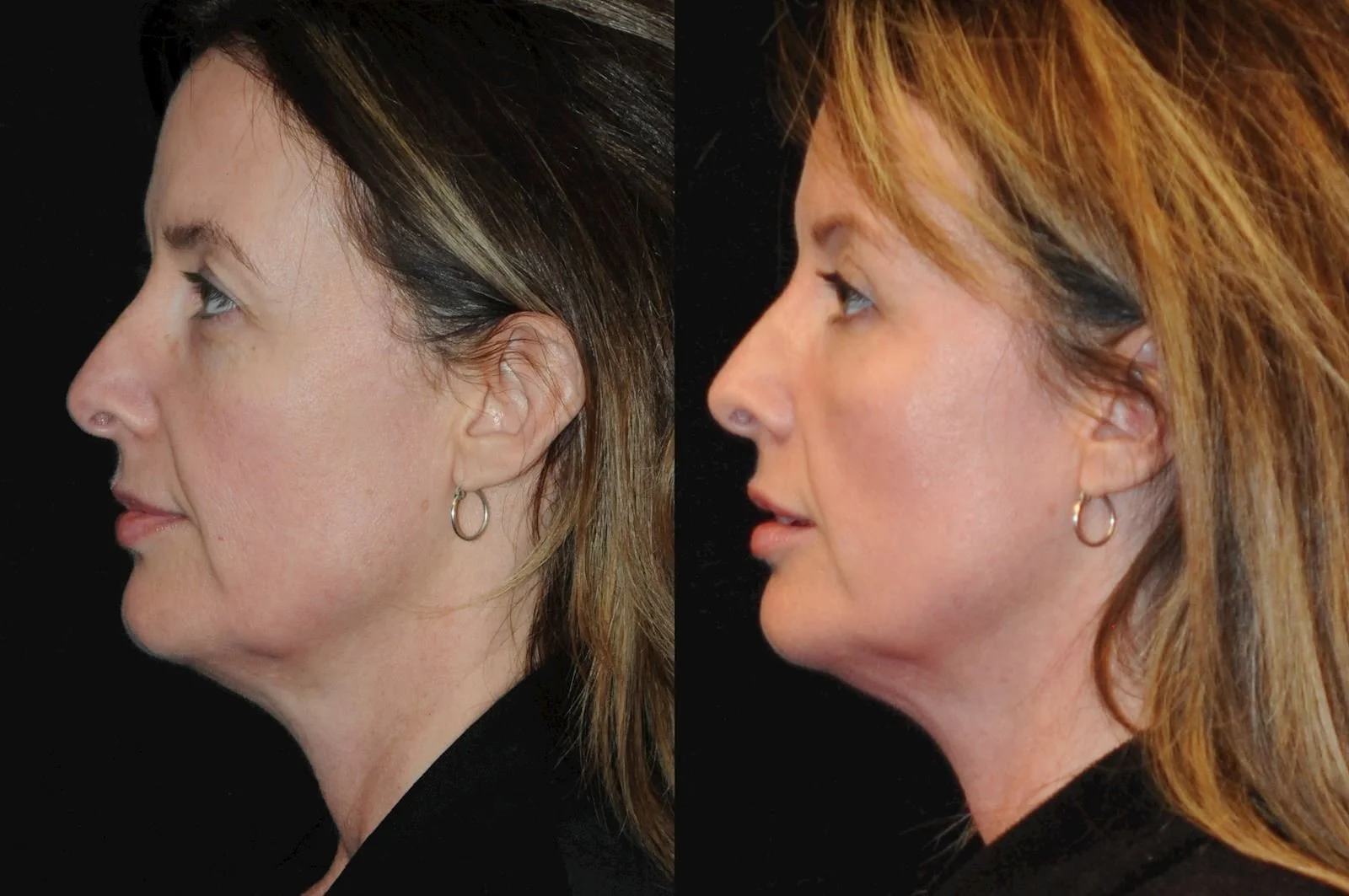 Allen, valena  (20150731140113400) 20170120162425785.jpg