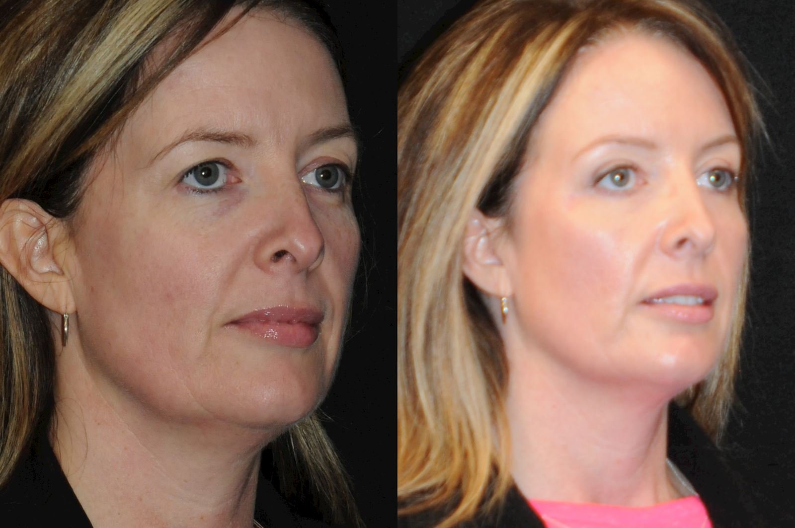 Allen, valena  (20150731140113400) 20170120162426768.jpg