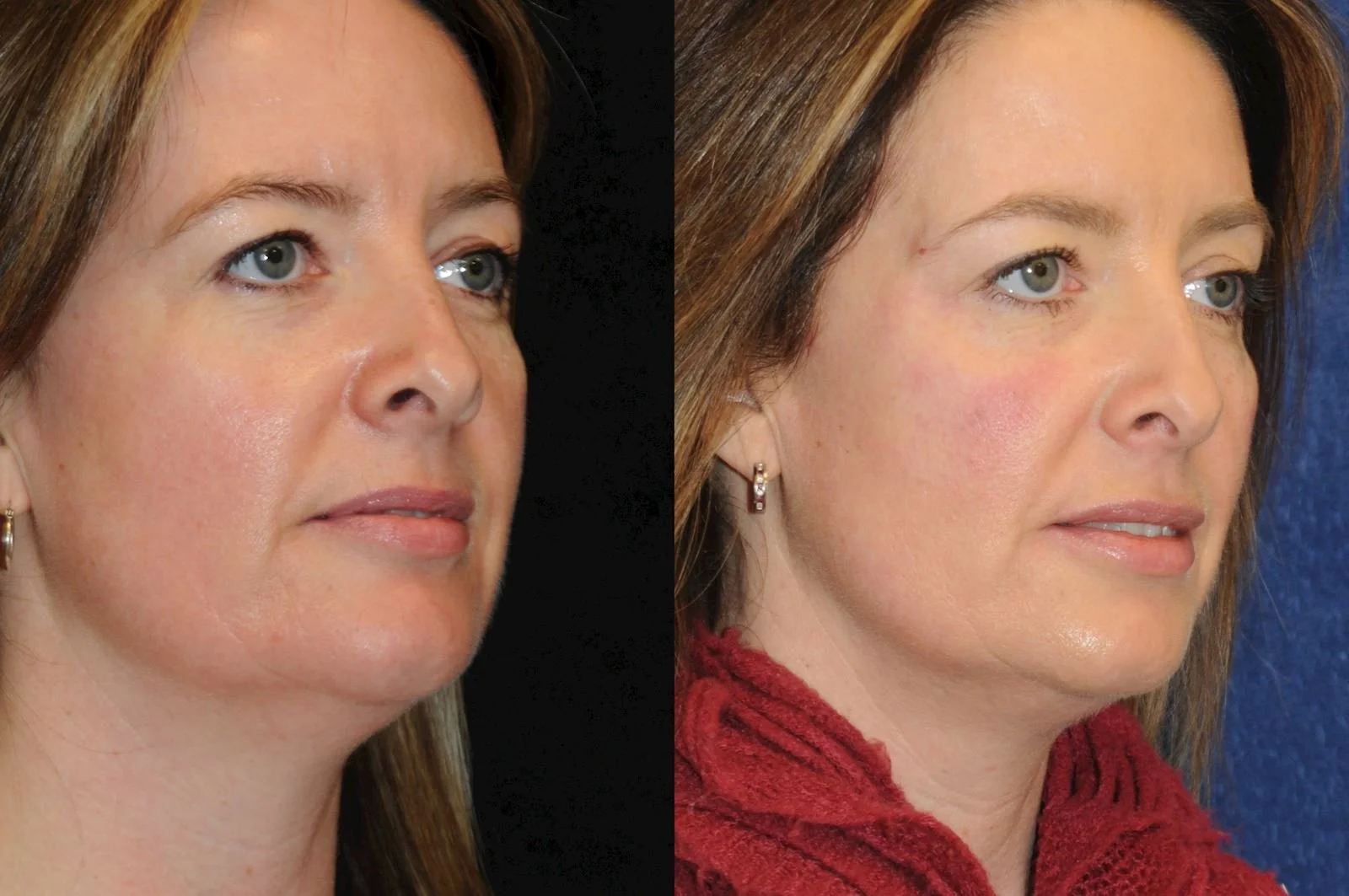 Allen, valena  (20150731140113400) 20160112082355722.jpg