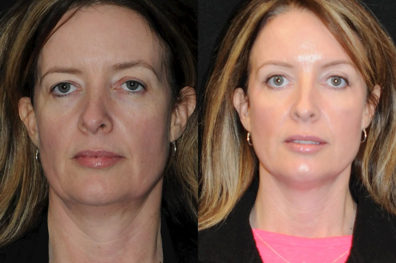 Allen, valena  (20150731140113400) 20170120162424724.jpg