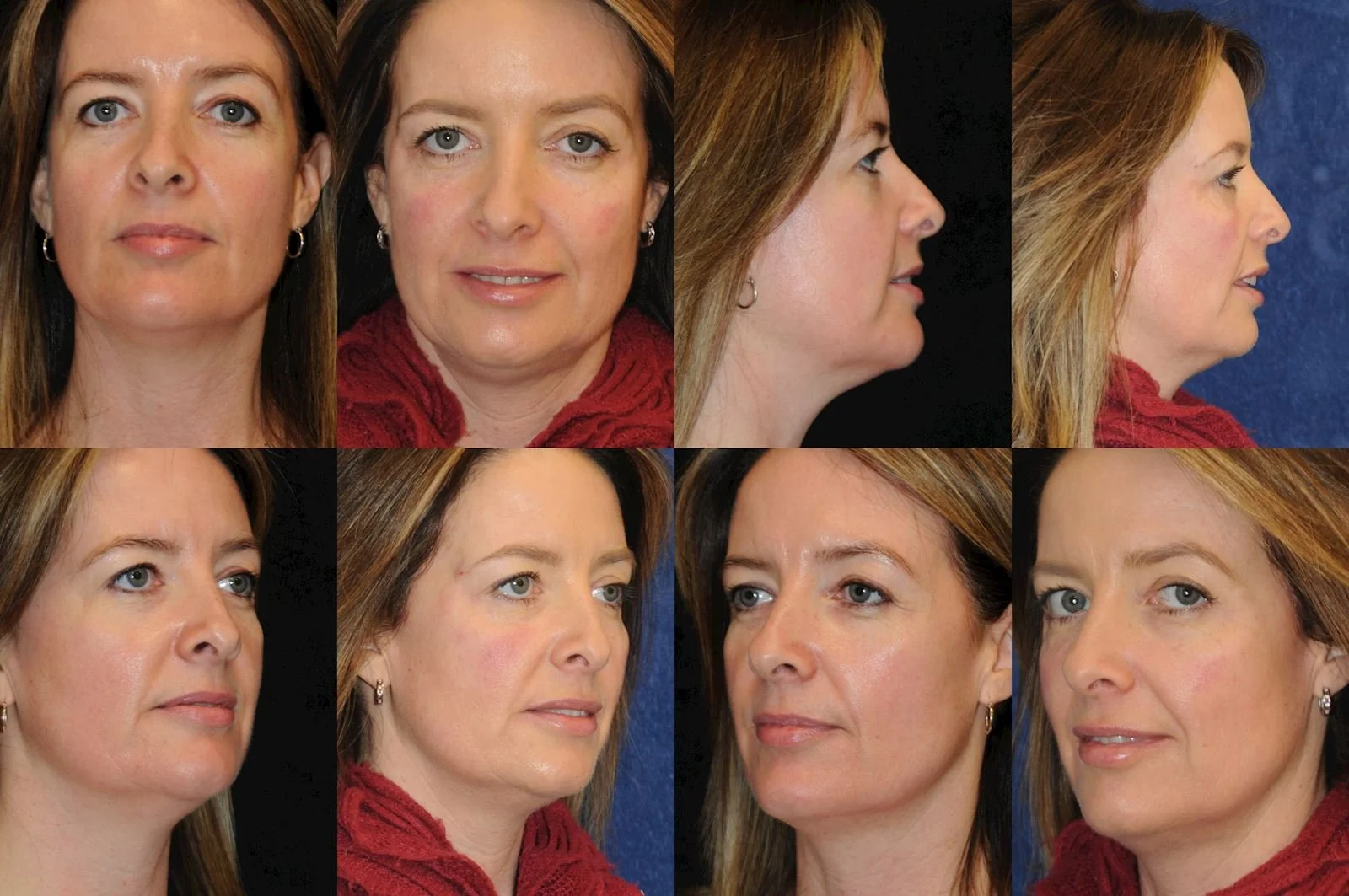 Allen, valena  (20150731140113400) 20160112082703951.jpg