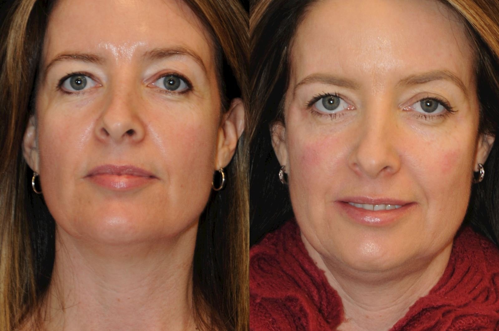 Allen, valena  (20150731140113400) 20160112082352571.jpg