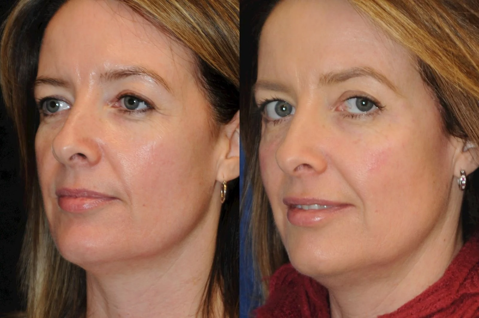 Allen, valena  (20150731140113400) 20160112082402776.jpg