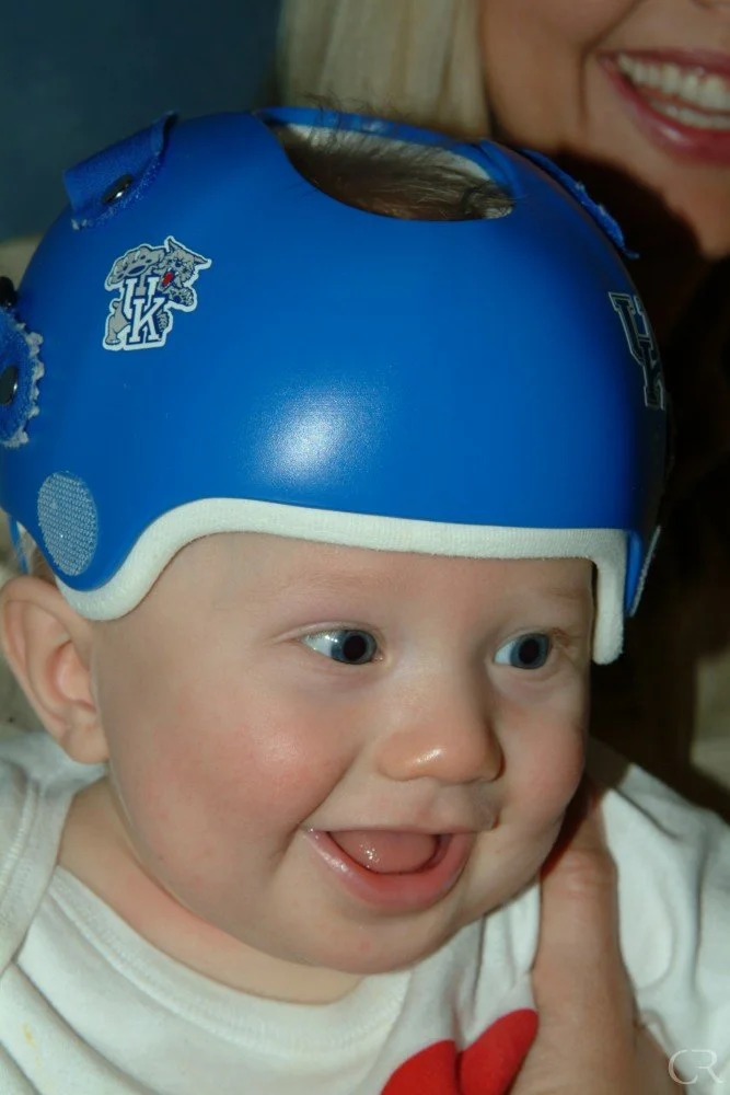 plagiocephaly-11.jpg