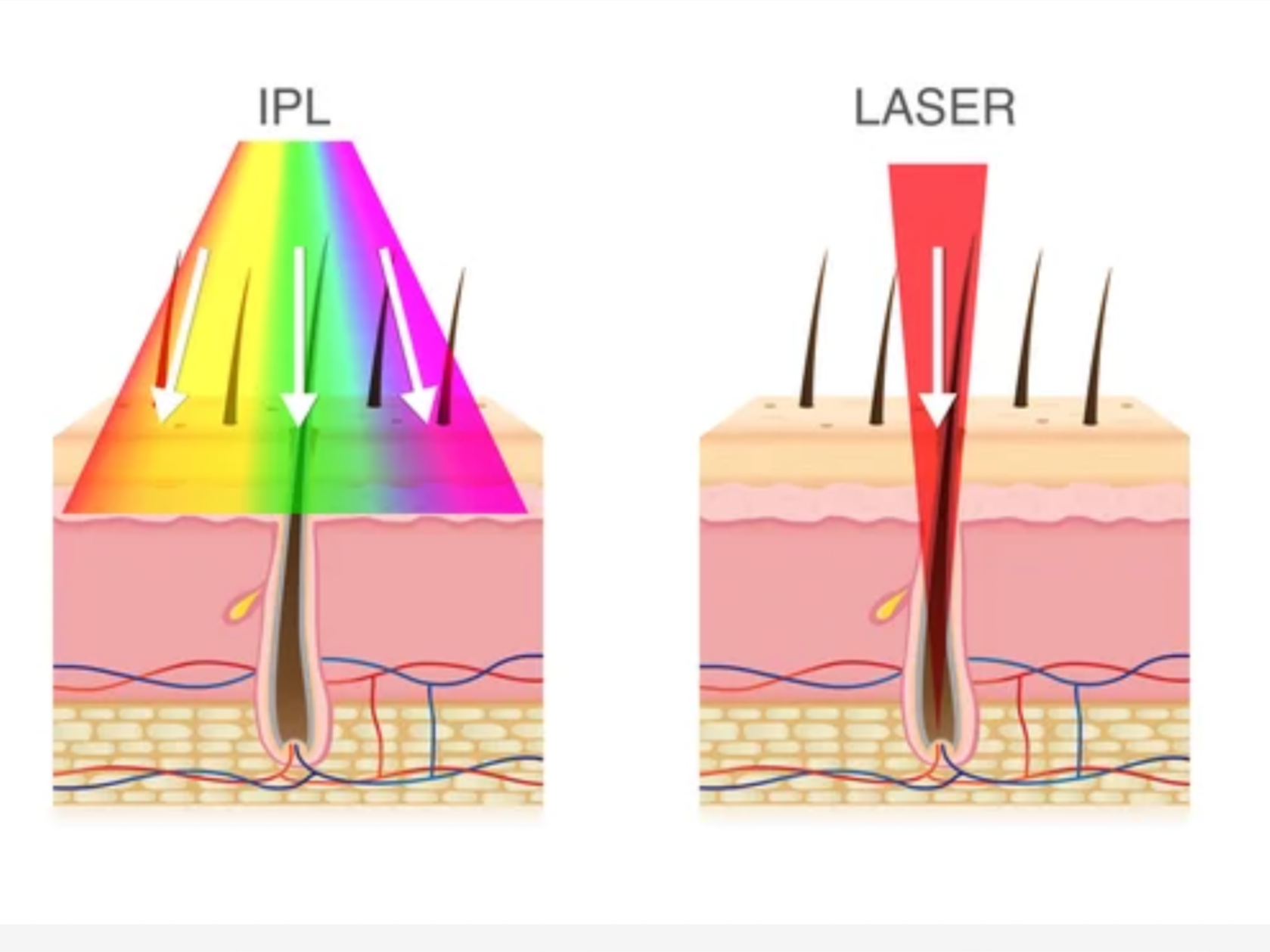 How MD Solar Sciences Supports Sensitive and Acne-Prone Skin