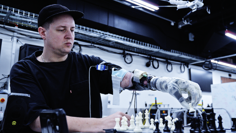 Tampa Man Tests Thought-Controlled Bionic Arm