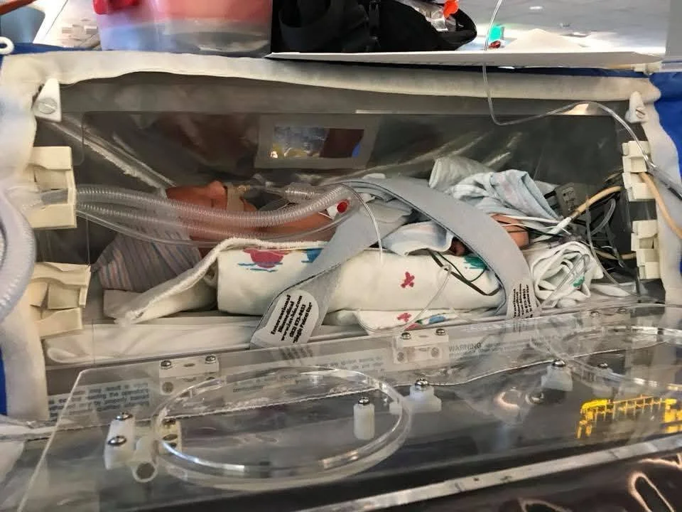 Early days of the fight against NKH. NICU Family. Rare Disease.
