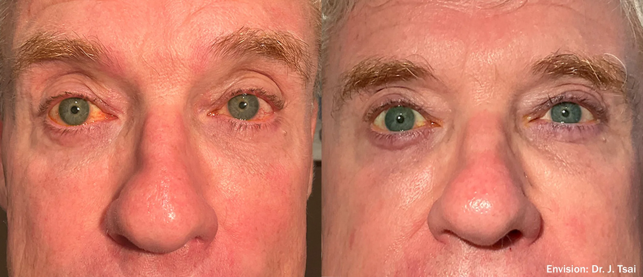 JT_Envision_Lumecca___Forma_Cheeks_14-TM.jpg