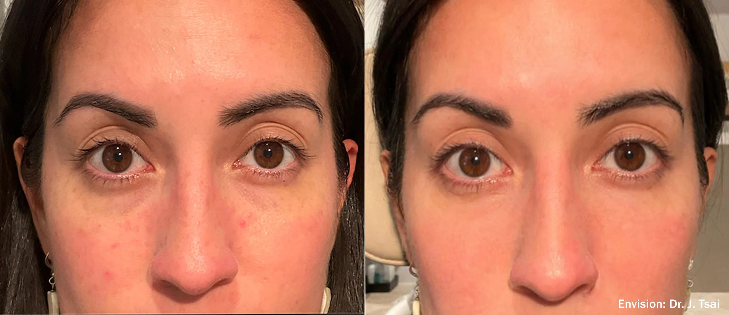 JT_Envision_Lumecca_Cheeks_6-TM.jpg
