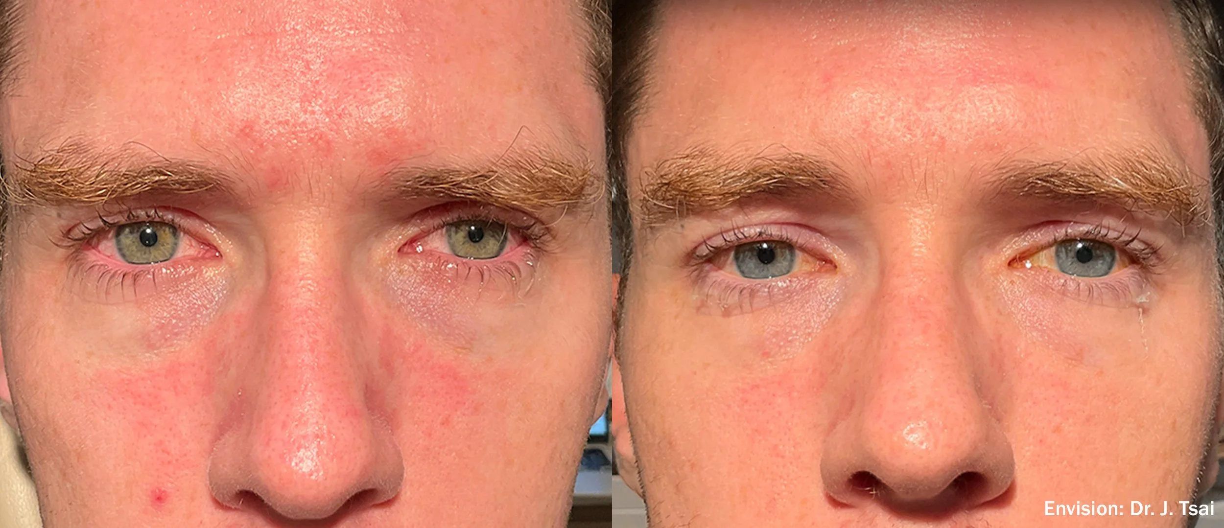 JT_Envision_Lumecca_Cheeks_7-TM.jpg