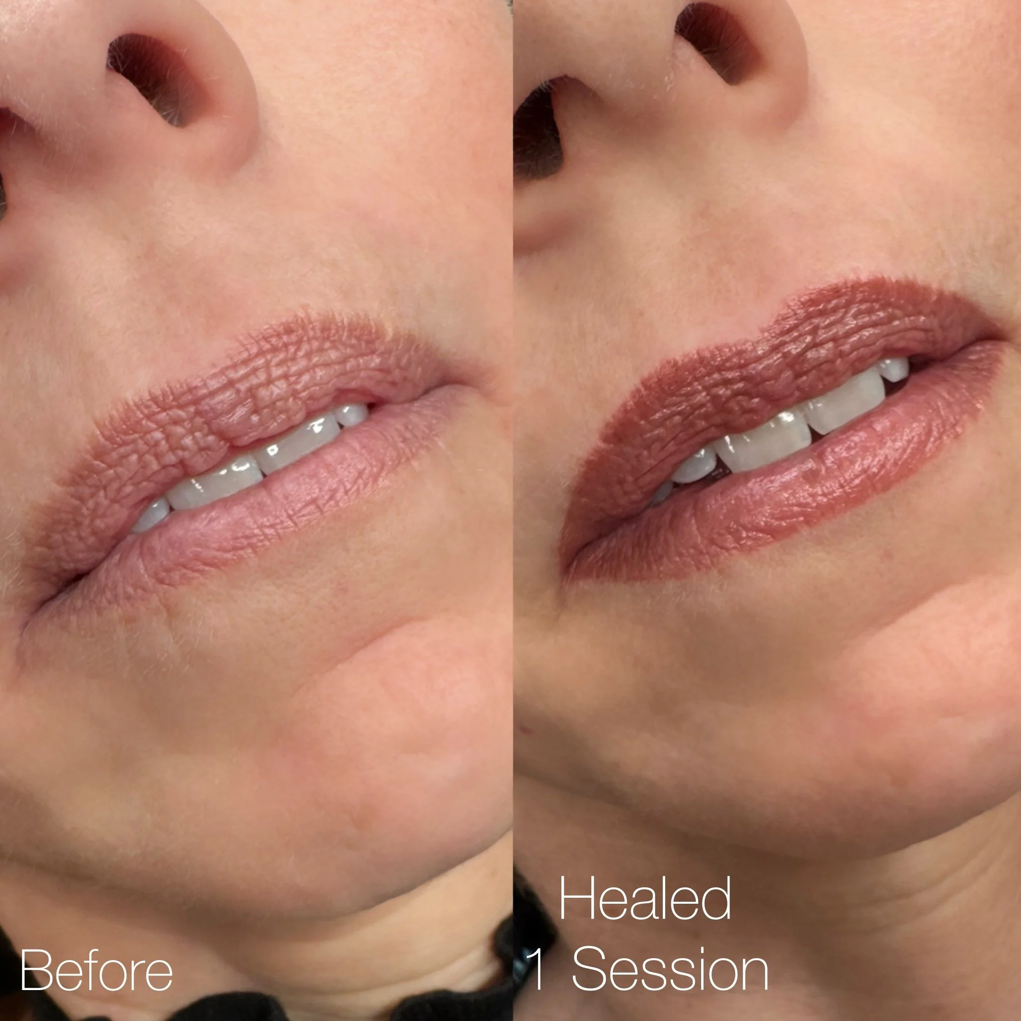 Close-up of a woman's lips before and after one session of a treatment, showing improvement in lip appearance. The left side labeled 'Before' shows slightly dry or chapped lips, and the right side labeled 'Healed 1 Session' shows smoother, more moist