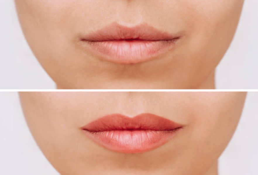 What is Lip Blush? Everything You Need to Know About This Semi-Permanent Lip Tattoo