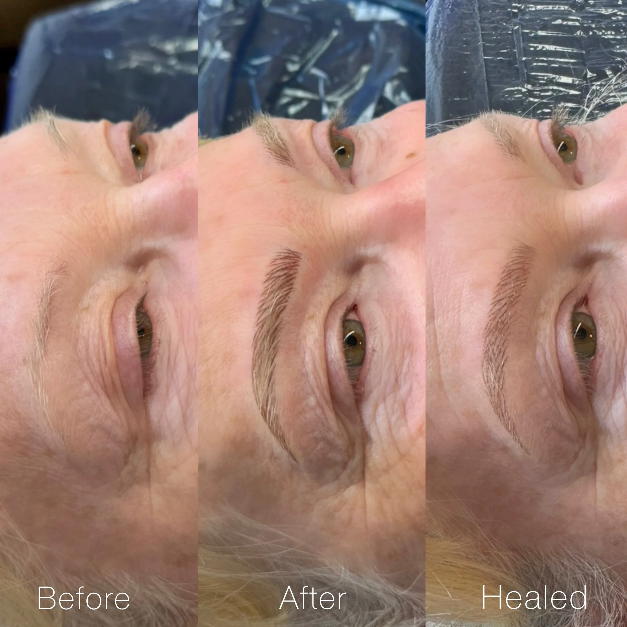 Progression of eyebrow transformation in three stages: before, after, and healed, with the woman lying down with her eyes open.