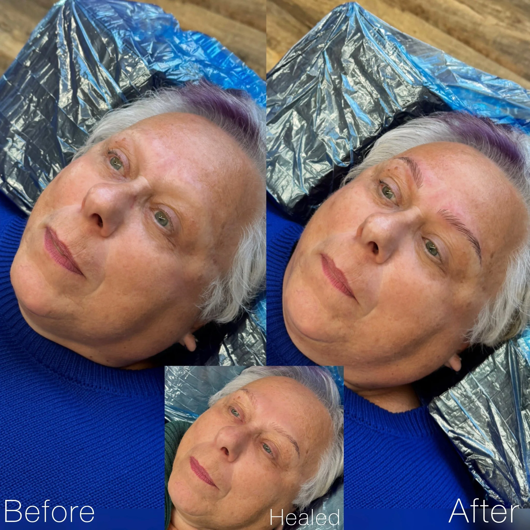 A side-by-side comparison of a woman before, during, and after cosmetic eyebrow treatment. The before shows sparse eyebrows, the healed shows newly shaped eyebrows, and the after shows fuller, more defined eyebrows.