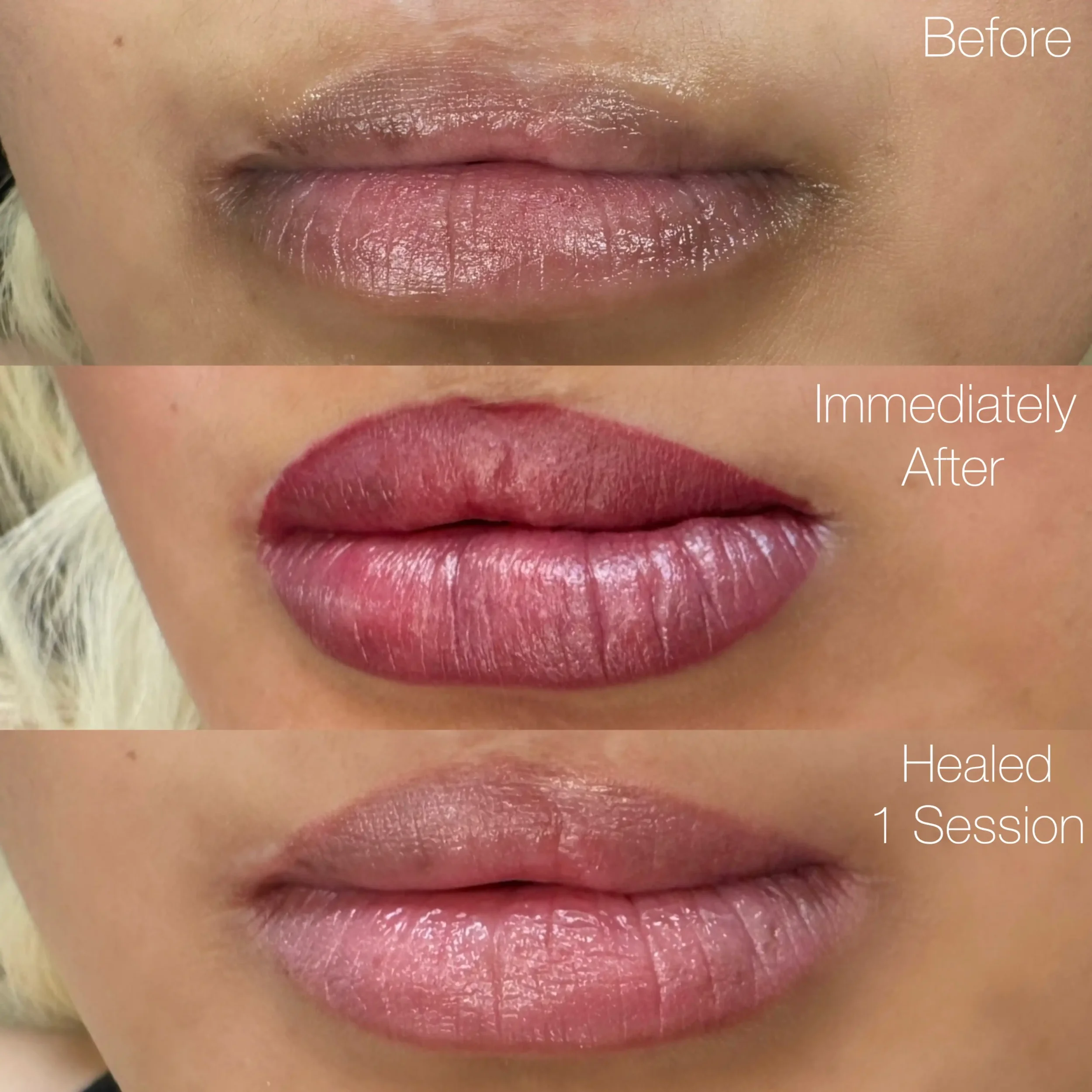 A sequence of three close-up images showing lips before, immediately after, and healed after a cosmetic lip treatment. The top image shows natural, unaltered lips. The middle image shows lips with fresh, bright red lipstick. The bottom image shows li
