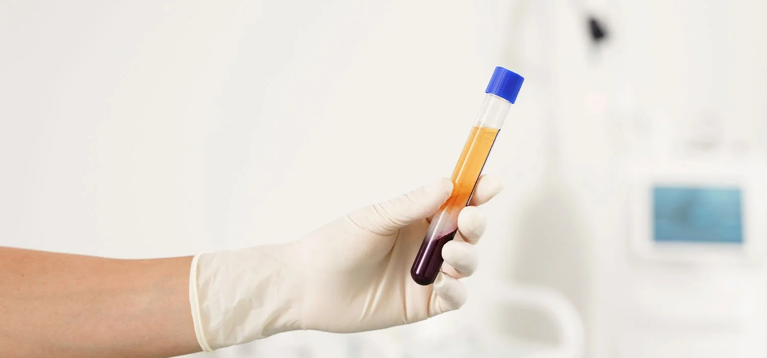 Medspa in Garden City, NY 11530 l PRF & PRG Near Me