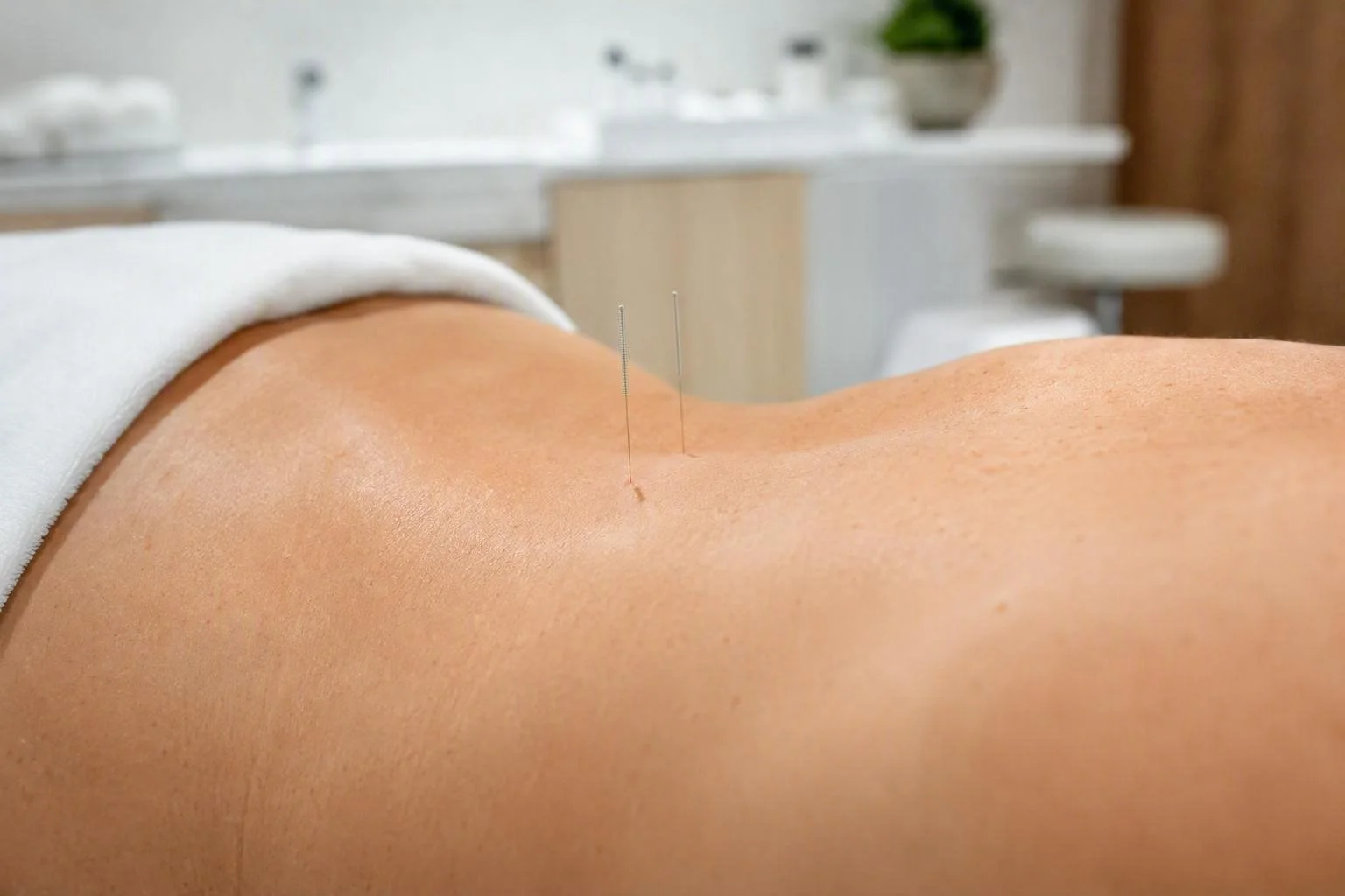 Acupuncture for Chronic Pain &amp; Musculoskeletal Injury Recovery
