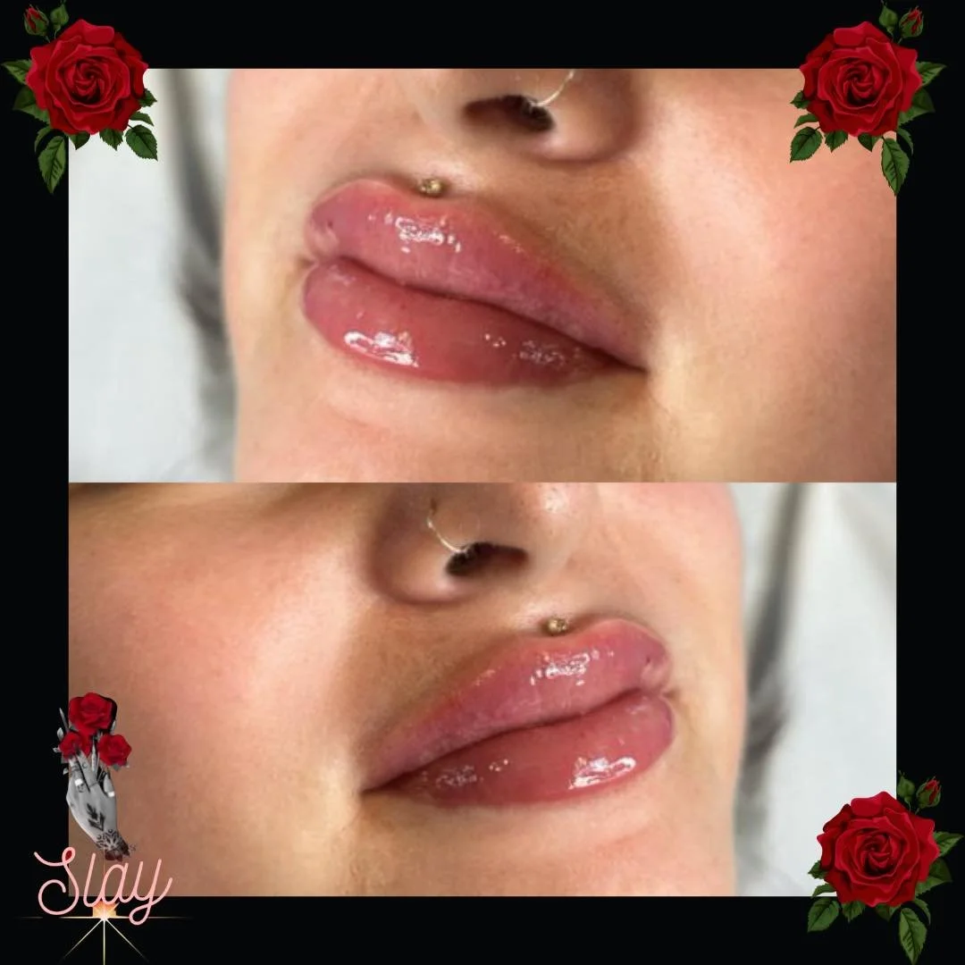 Your lips, your rules. Embrace the beauty of self-expression! 💋💄
&bull;
&bull;
&bull;
&bull;
&bull;
&bull;
&bull;
&bull;
&bull;
&bull;
&bull;
&bull;
&bull;
&bull;
&bull;
&bull;
&bull;
&bull;
 1. #WrinkleFree
 2. #AgelessBeauty
 3. #SmoothSkin
 4. #