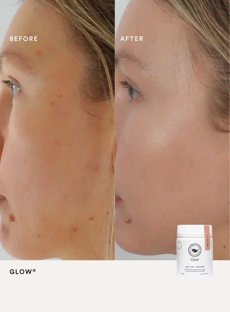 TBC_Glow_PDP_B_A3_750x1014_61723f61-c76d-4ef1-a3f7-515f50aa6aba_1200x.webp (Copy)