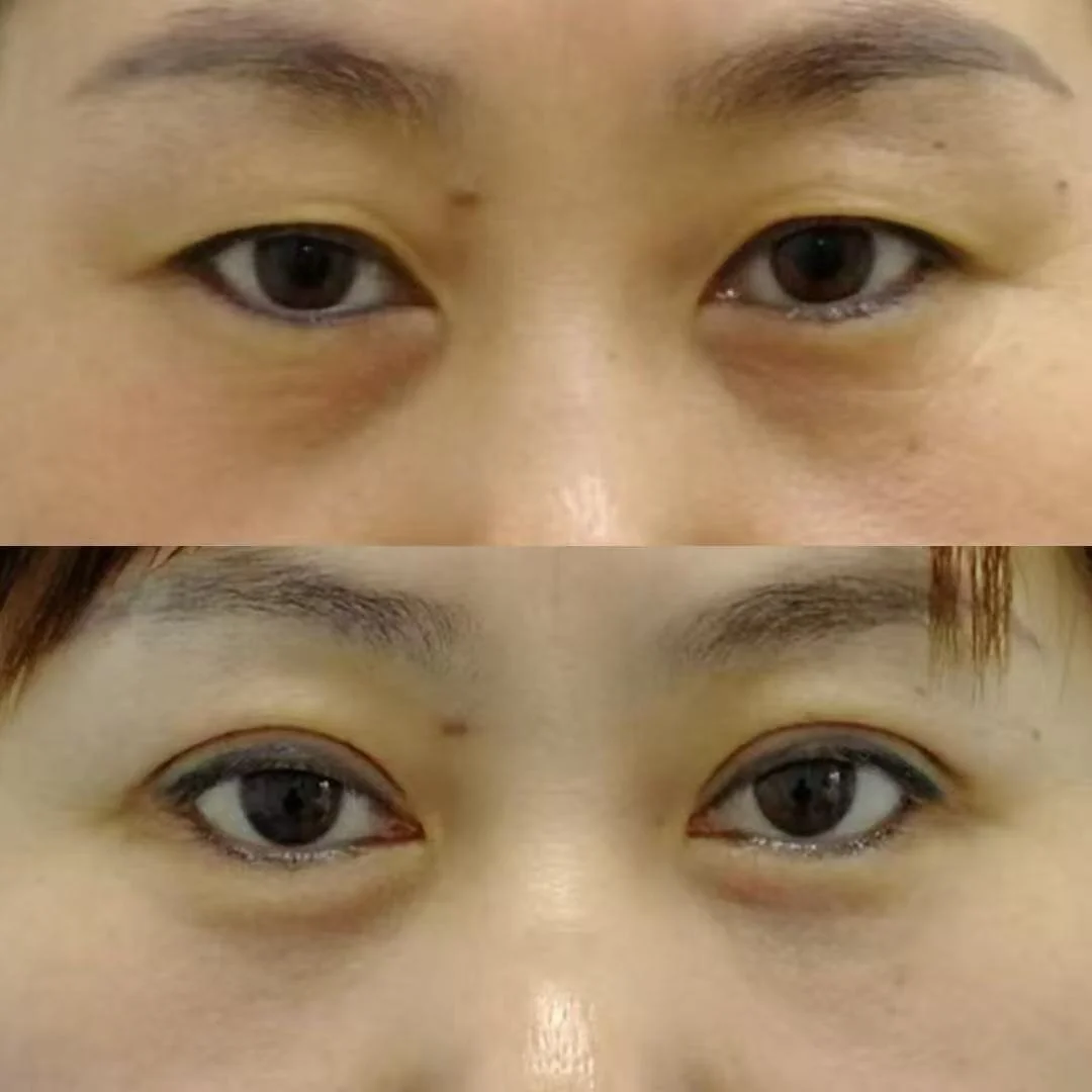 Close-up of two pairs of eyes, showing differences in eyelid and eye shape, with the top and bottom images