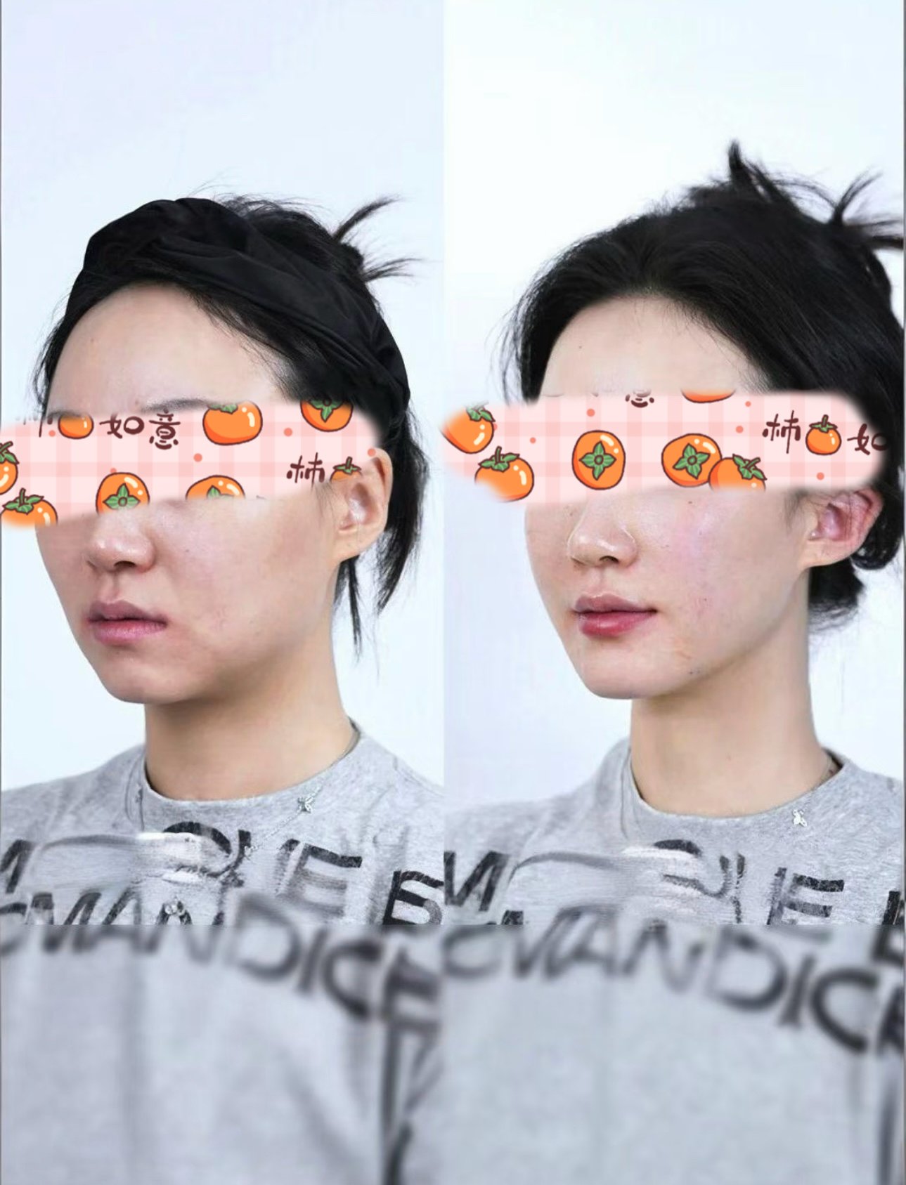 Side-by-side comparison of a woman before and after skincare, with her eyes obscured by a graphic overlay of oranges and Chinese characters. In the 'after' photo, her skin appears clearer and more radiant.