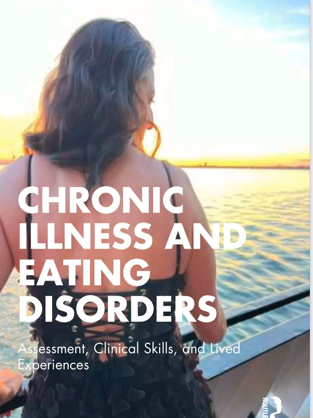 ✨ 7 years ago today, my life was forever changed. On this day, I began my journey through surgery #1 &amp; #2 of 3, undergoing a transformative procedure to correct my curve and severely diseased lumbar discs. 💪💖 

This past year has been a roller 