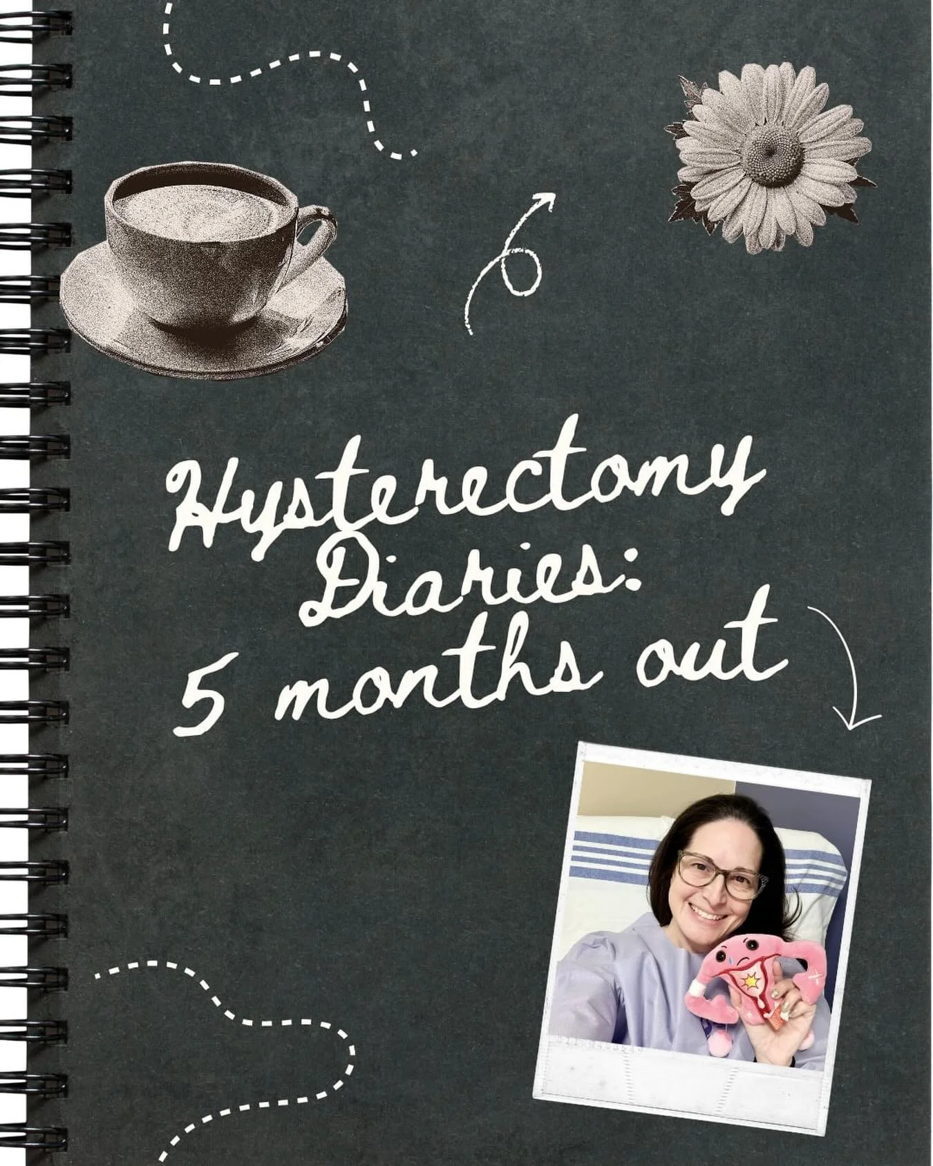 Hi friends, this is raw and real and intense. It&rsquo;s so hard to put my experience into words. This is not everyone&rsquo;s experience with hysterectomy, but it has been mine and I wanted to give voice to it in case other women have experienced or