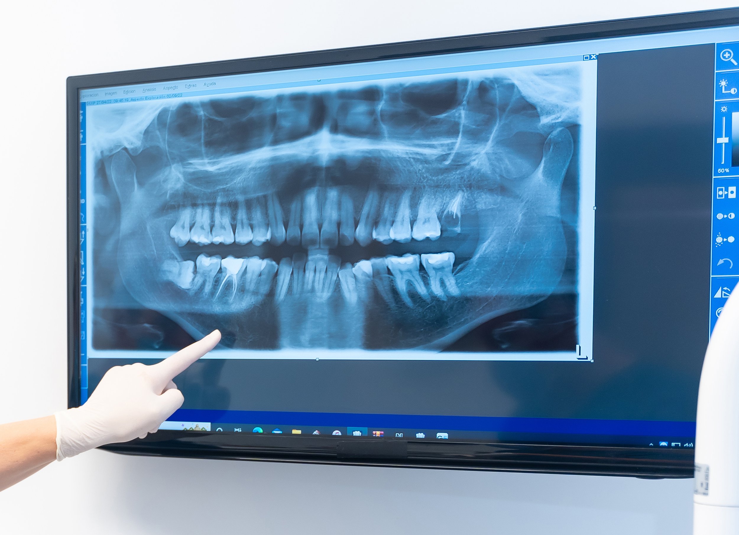 softly dental exam x-ray.jpg
