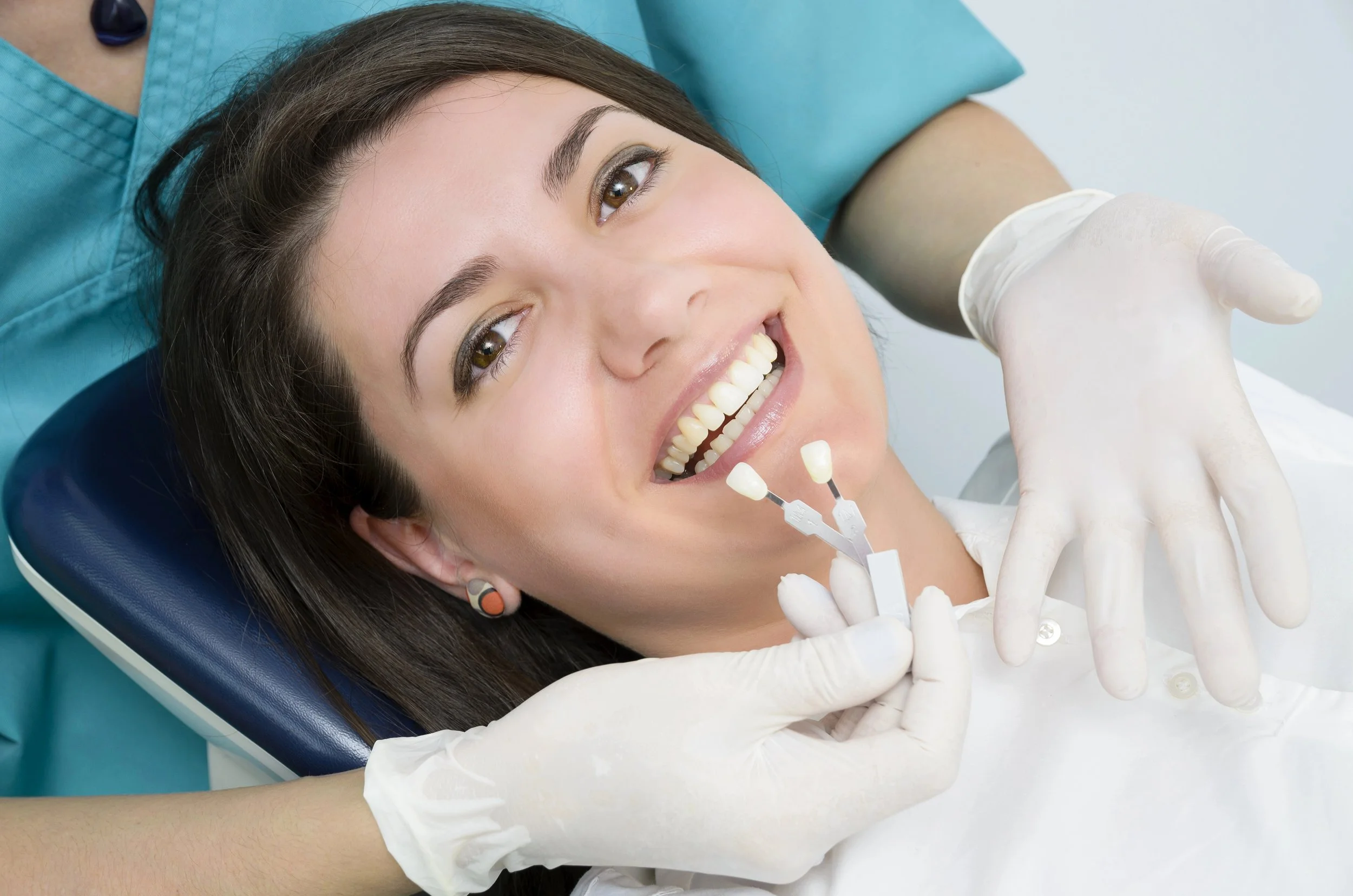 softly dental veneers 1.jpg