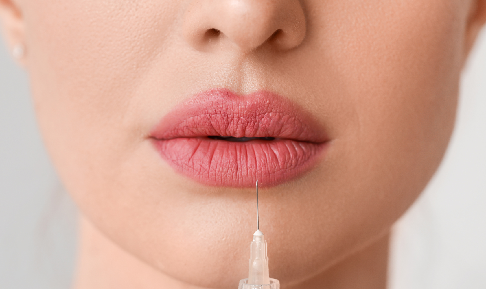 Medspa in Santa Barbara, CA, 93101  Fillers Near Me.png