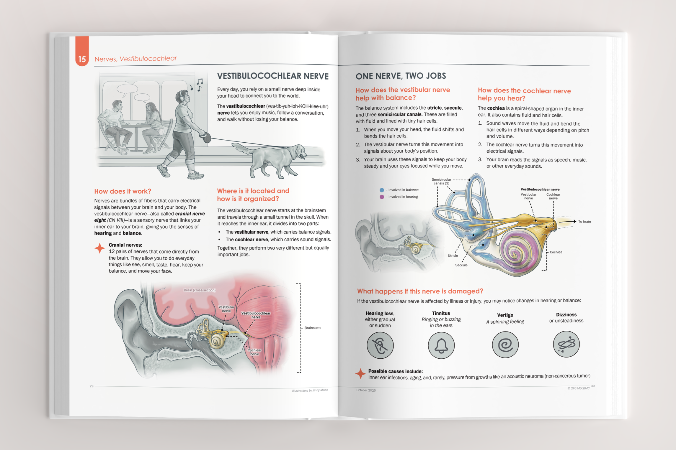 Vestibulocochlear nerve (Patient education spread – Procreate, Illustrator)