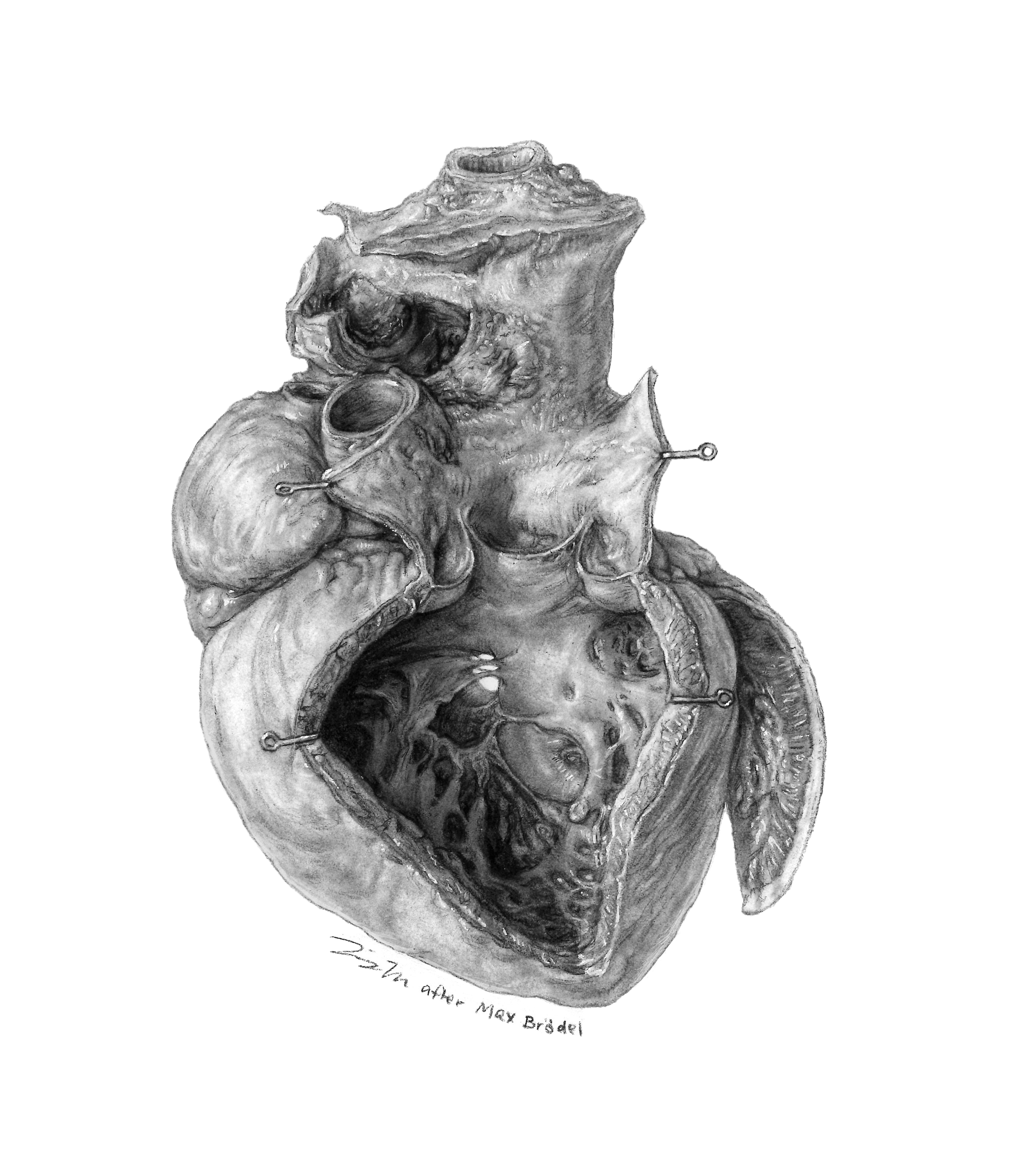 Max Brödel master study (Anatomical illustration – carbon dust)