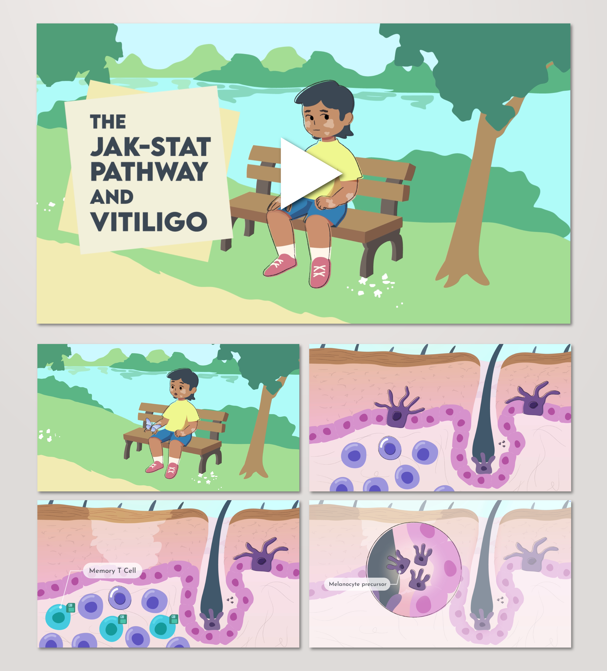 The JAK-STAT pathway and vitiligo (Group 2D animation – Illustrator, After Effects)