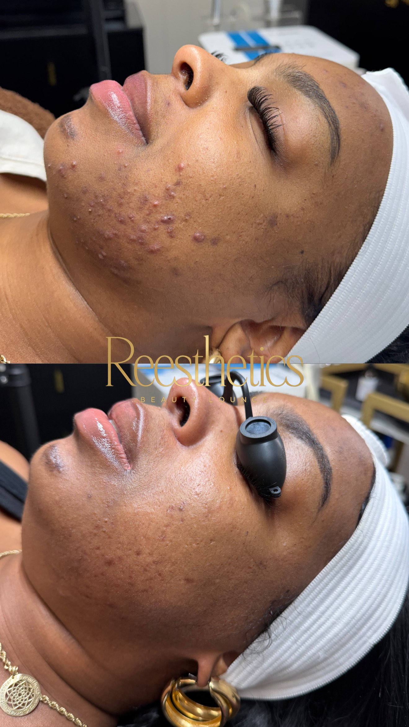 Mercedes Skin Transformation 1.JPG