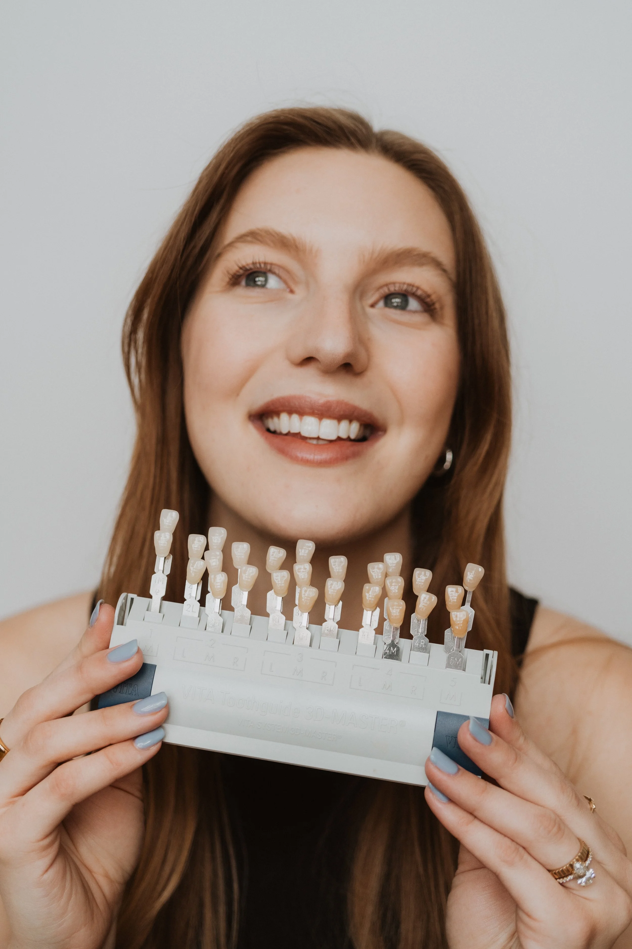 Veneers in Calgary: Costs, Process, and Whether They Are Right for You