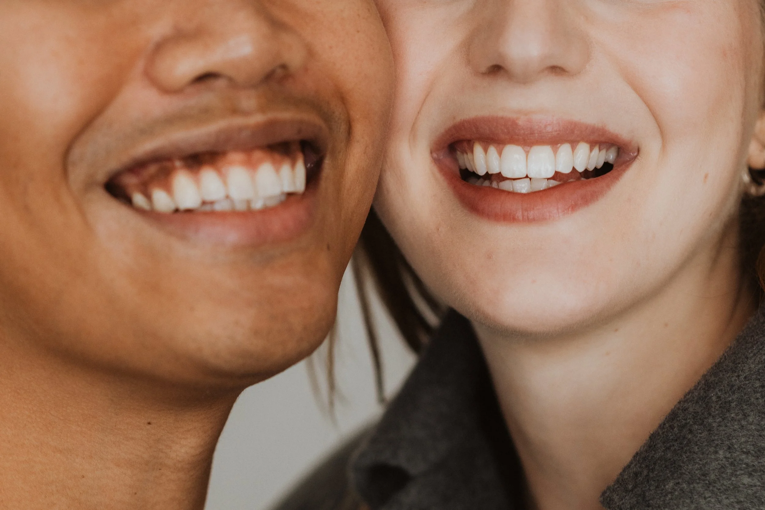 3D Printed Veneers: What They Are and How They Compare to Traditional Ones