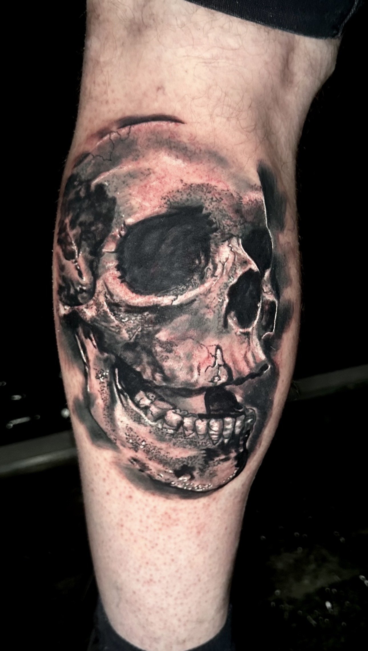A realistic black and gray tattoo of a human skull on person's calf.